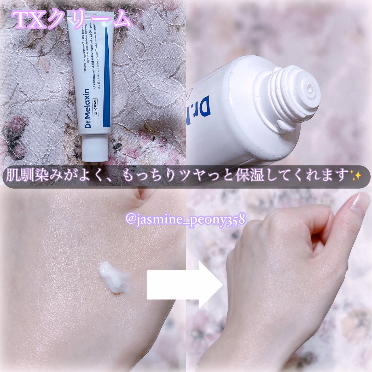TX-Cream/Dr.Melaxin/フェイスクリームを使ったクチコミ(4枚目)