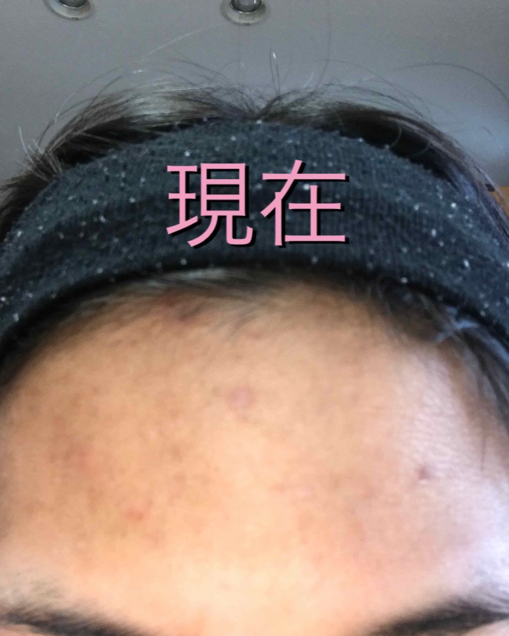 薬用パウダー化粧水/メンソレータム アクネス/化粧水を使ったクチコミ(3枚目)