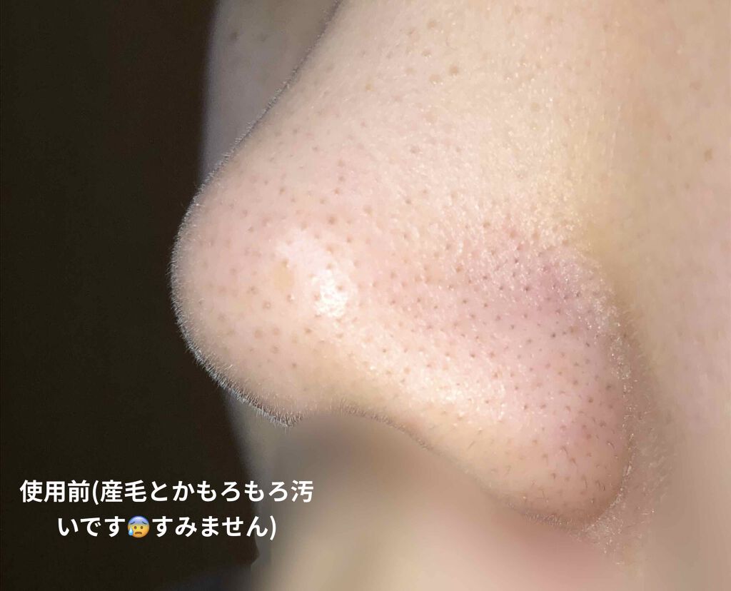 デュオ ザ クレンジングバーム/DUO/クレンジングバームを使ったクチコミ(2枚目)