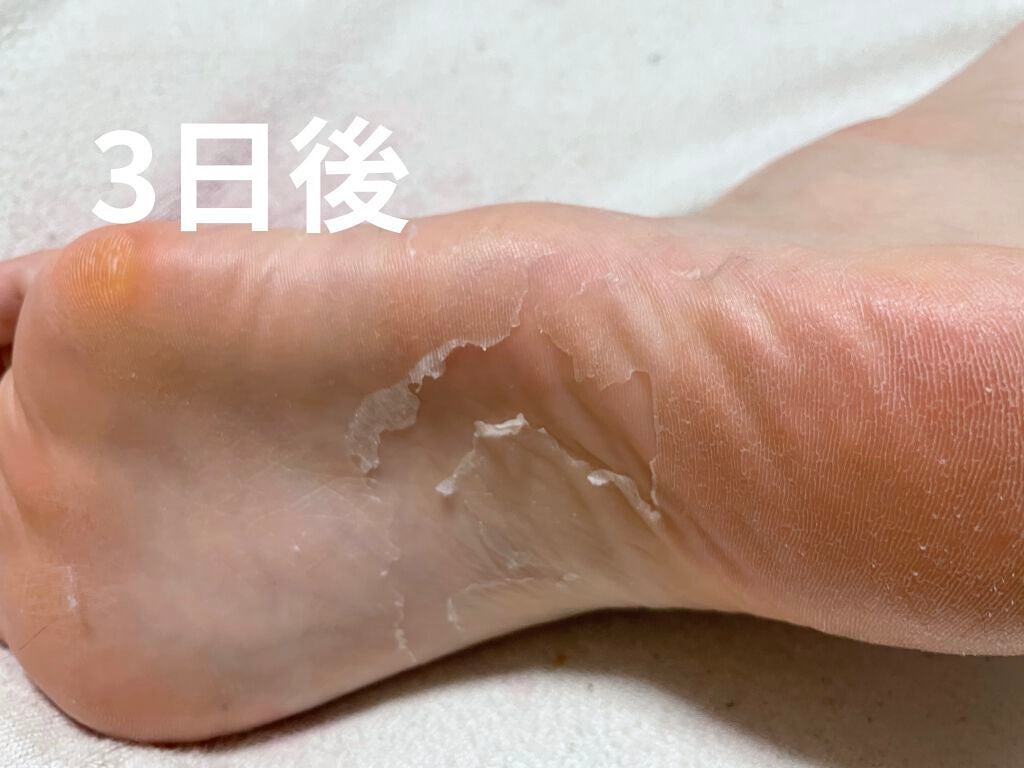 足裏ランラン エキスプレス/MYM/レッグ・フットケアを使ったクチコミ(3枚目)