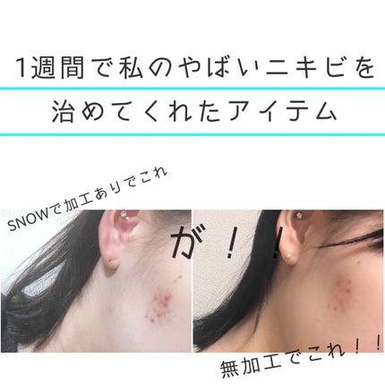 グリーンティーシード セラム/innisfree/美容液を使ったクチコミ(1枚目)