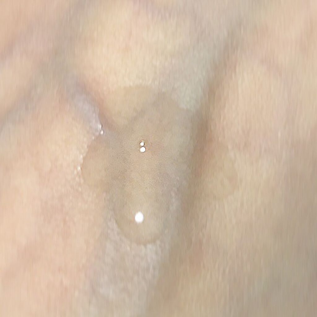 AZアゼライン酸10セラム/コスデバハ/美容液を使ったクチコミ(3枚目)