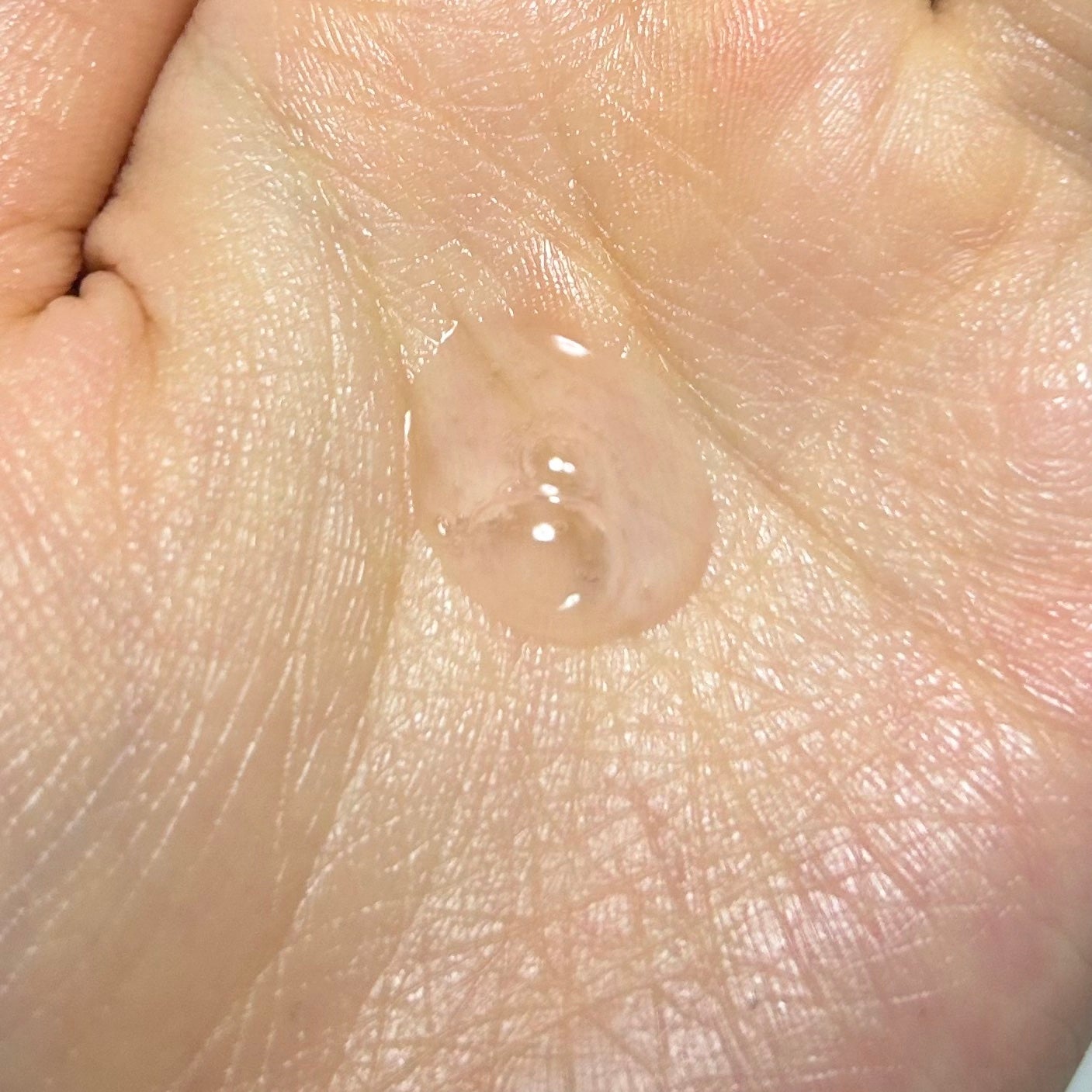 ピンクティーツリーシナジーセラム/APLIN/美容液を使ったクチコミ(2枚目)