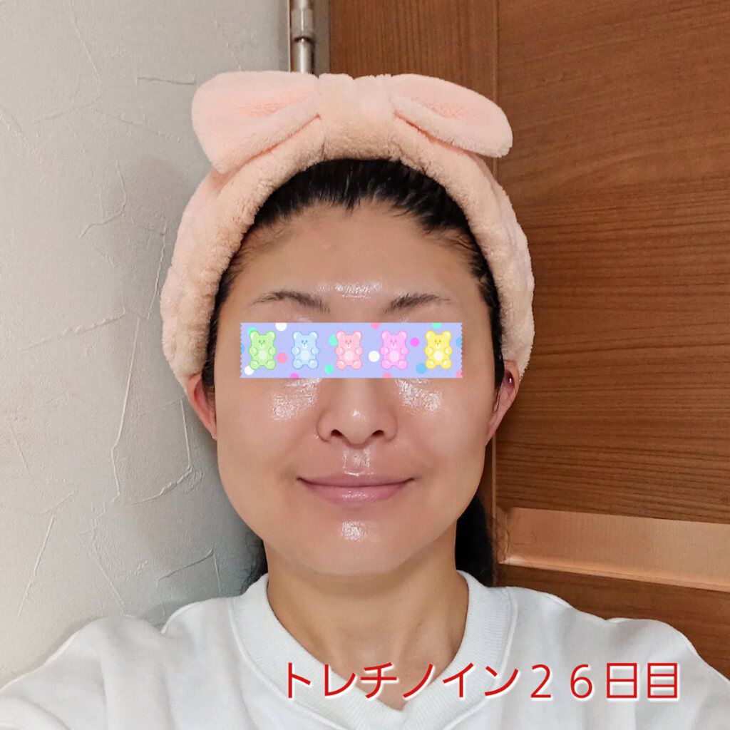 リンクルシートマスク Ｎ/なめらか本舗/シートマスク・パックを使ったクチコミ（1枚目）