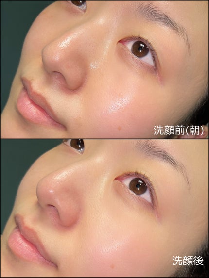 ティーツリーコントロール酵素洗顔パウダー/PAPA RECIPE/洗顔パウダーを使ったクチコミ(6枚目)