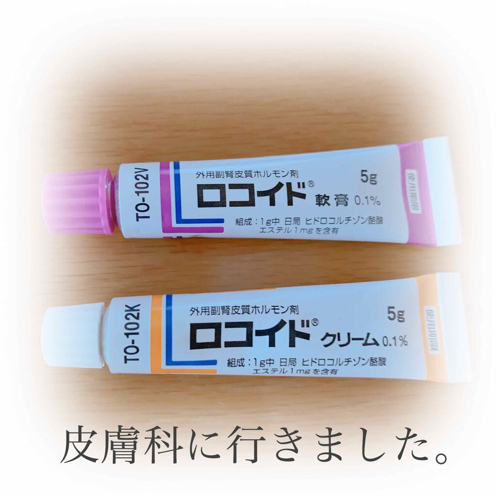 ロコイド軟膏/鳥居薬品/その他を使ったクチコミ（1枚目）