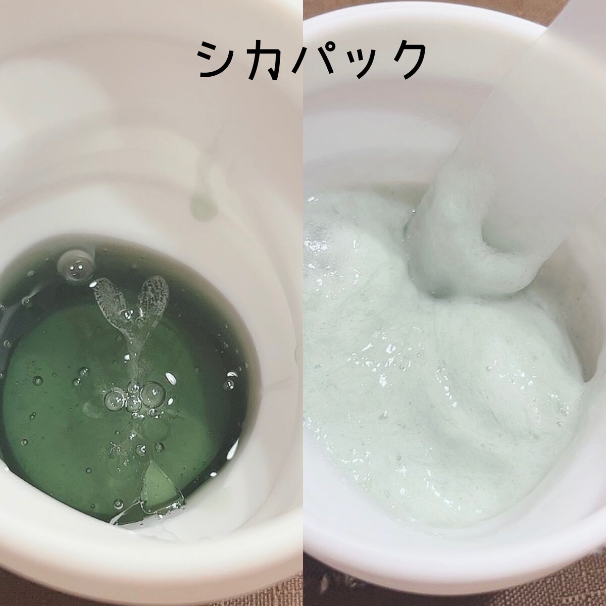 ニードル炭酸パック/NNE/洗い流すパック・マスクを使ったクチコミ（3枚目）