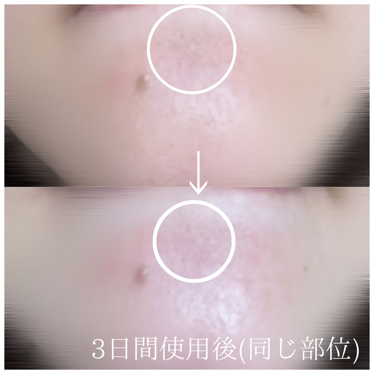 ワンデイズユー ディープクレンジグオイル/One-day's you/オイルクレンジングを使ったクチコミ(4枚目)