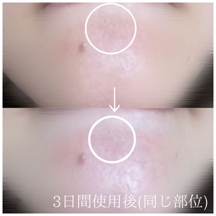 ワンデイズユー ディープクレンジグオイル/One-day's you/オイルクレンジングを使ったクチコミ(4枚目)