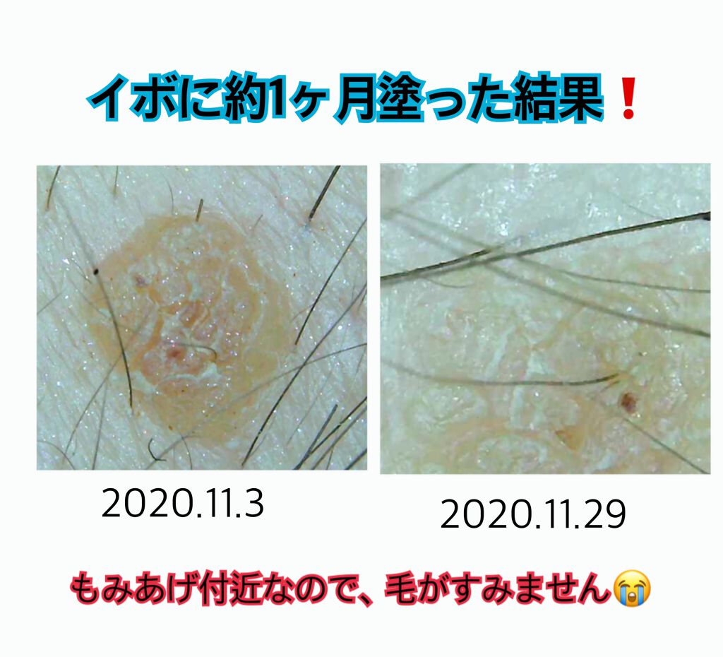 キャスターオイル/Now Foods/その他スキンケアを使ったクチコミ（3枚目）