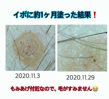 キャスターオイル/Now Foods/その他スキンケアを使ったクチコミ(3枚目)