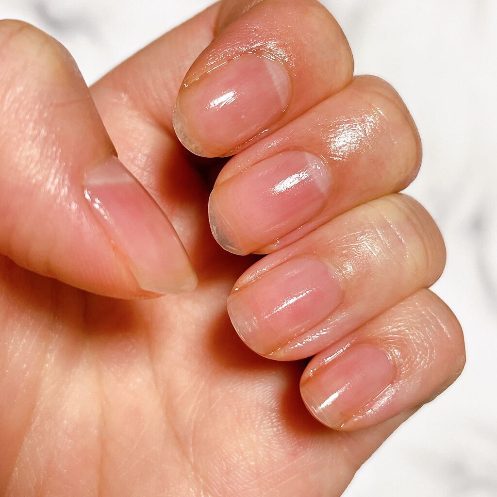 デグー♪フォロバ on LIPS 「筆タイプのネイルオイルです💅ネイルベッド育成中なのでハイポニキ..」(5枚目)