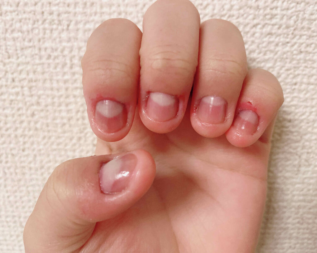 AC キューティクルオイル/AC MAKEUP/ネイルオイル・トリートメントを使ったクチコミ（2枚目）