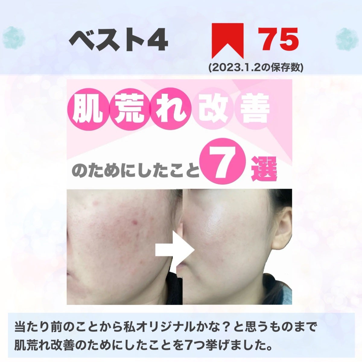 潤浸保湿 乳液/キュレル/乳液を使ったクチコミ(7枚目)