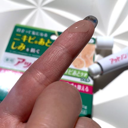 ニキビあとケアジェル/アットノン/その他スキンケアを使ったクチコミ(5枚目)