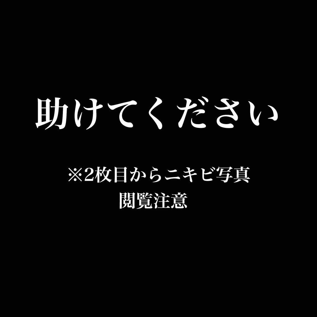 ハトムギ化粧水(ナチュリエ スキンコンディショナー R )/ナチュリエ/化粧水を使ったクチコミ(1枚目)