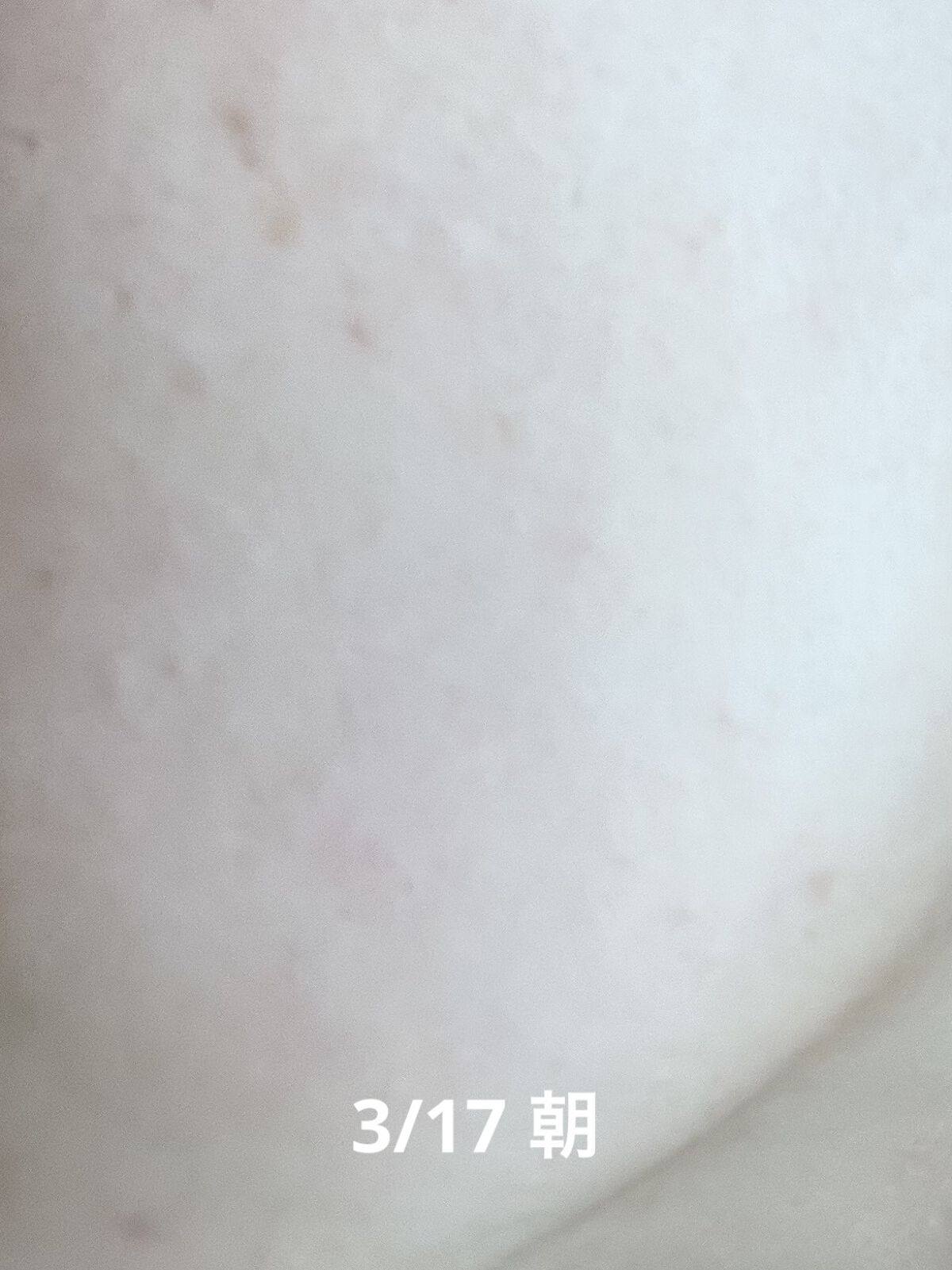 RXザ・レチノール0.1クリーム/COSRX/フェイスクリームを使ったクチコミ（3枚目）