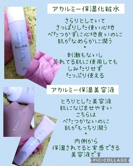 アカルミー化粧水/ワイズ/化粧水を使ったクチコミ(2枚目)