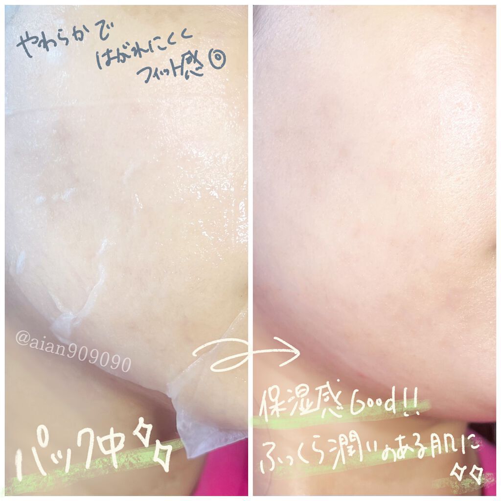 シラカバモイスチャーマスクパック/Anua/シートマスク・パックを使ったクチコミ(3枚目)