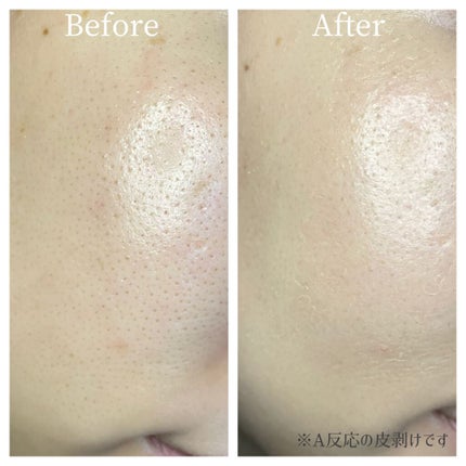 エッセンスハーブバームクリーム/MiMC/フェイスバームを使ったクチコミ(2枚目)