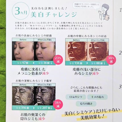 ホワイトアンサー/ジェルニック/美容液を使ったクチコミ(5枚目)