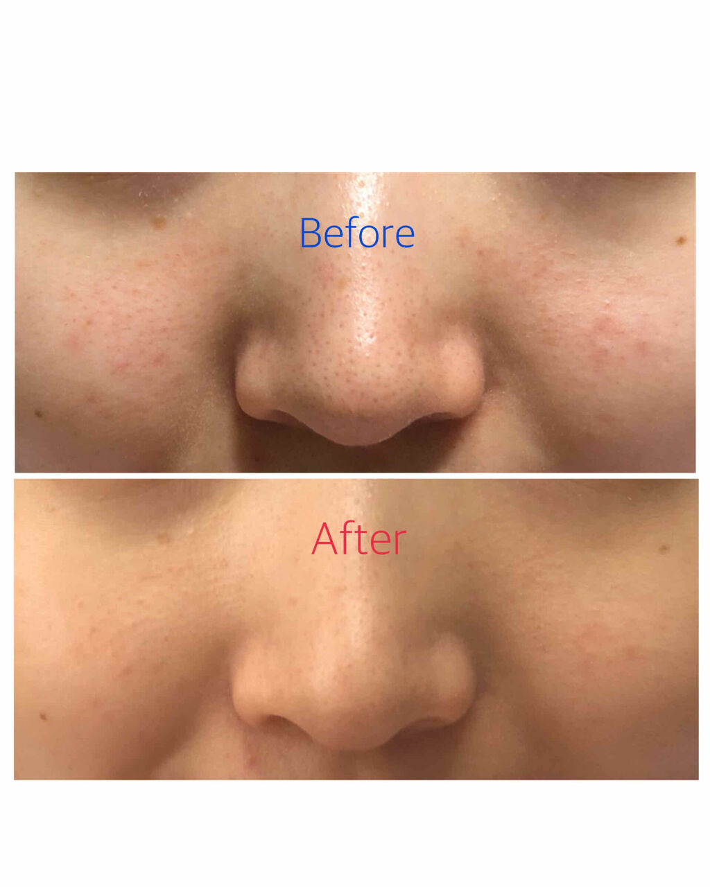 ヴェール ファンデーション/PAUL & JOE BEAUTE/パウダーファンデーションを使ったクチコミ（2枚目）