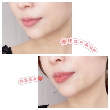 なおちゃん on LIPS 「あんにょん❤️ㅤㅤㅤㅤㅤㅤㅤㅤㅤㅤㅤㅤㅤまるでフィラーをしたよ..」(2枚目)