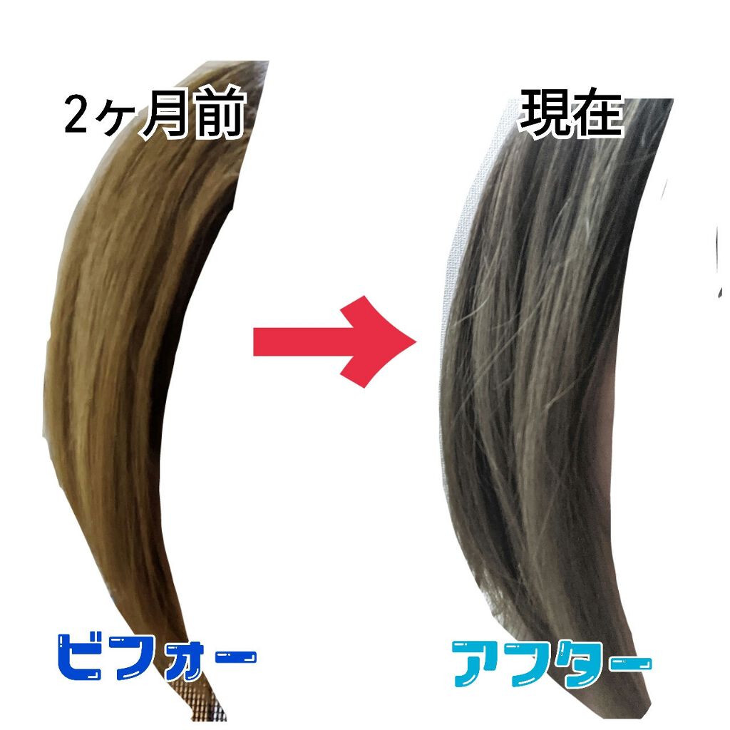 生活の木 アンナドンナ セット