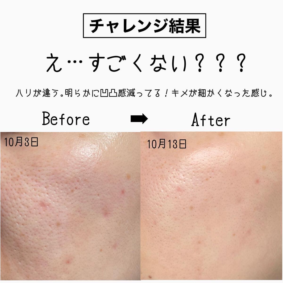 RXザ・ビタミンC23セラム/COSRX/美容液を使ったクチコミ(2枚目)