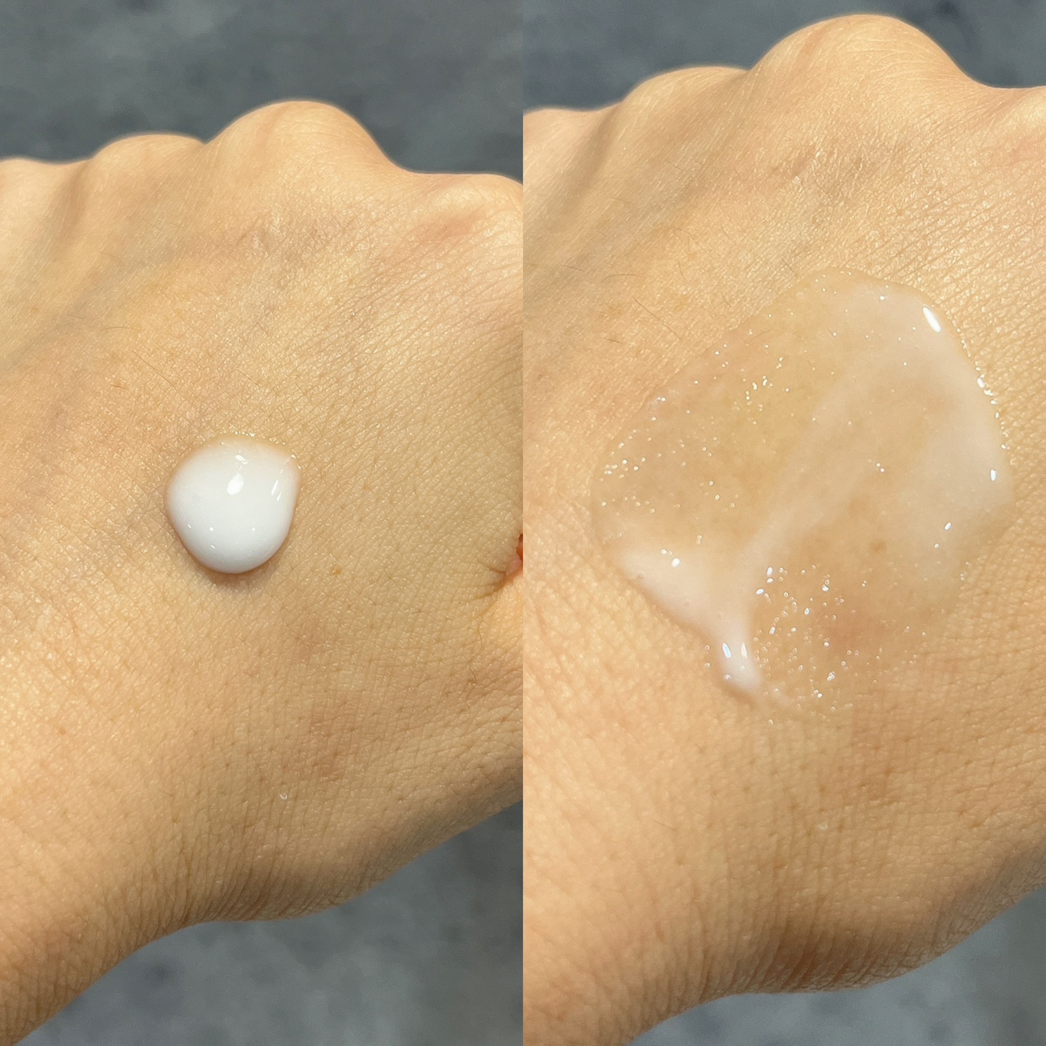 アゼペア 美容液/ネイチャーリパブリック/美容液を使ったクチコミ（3枚目）