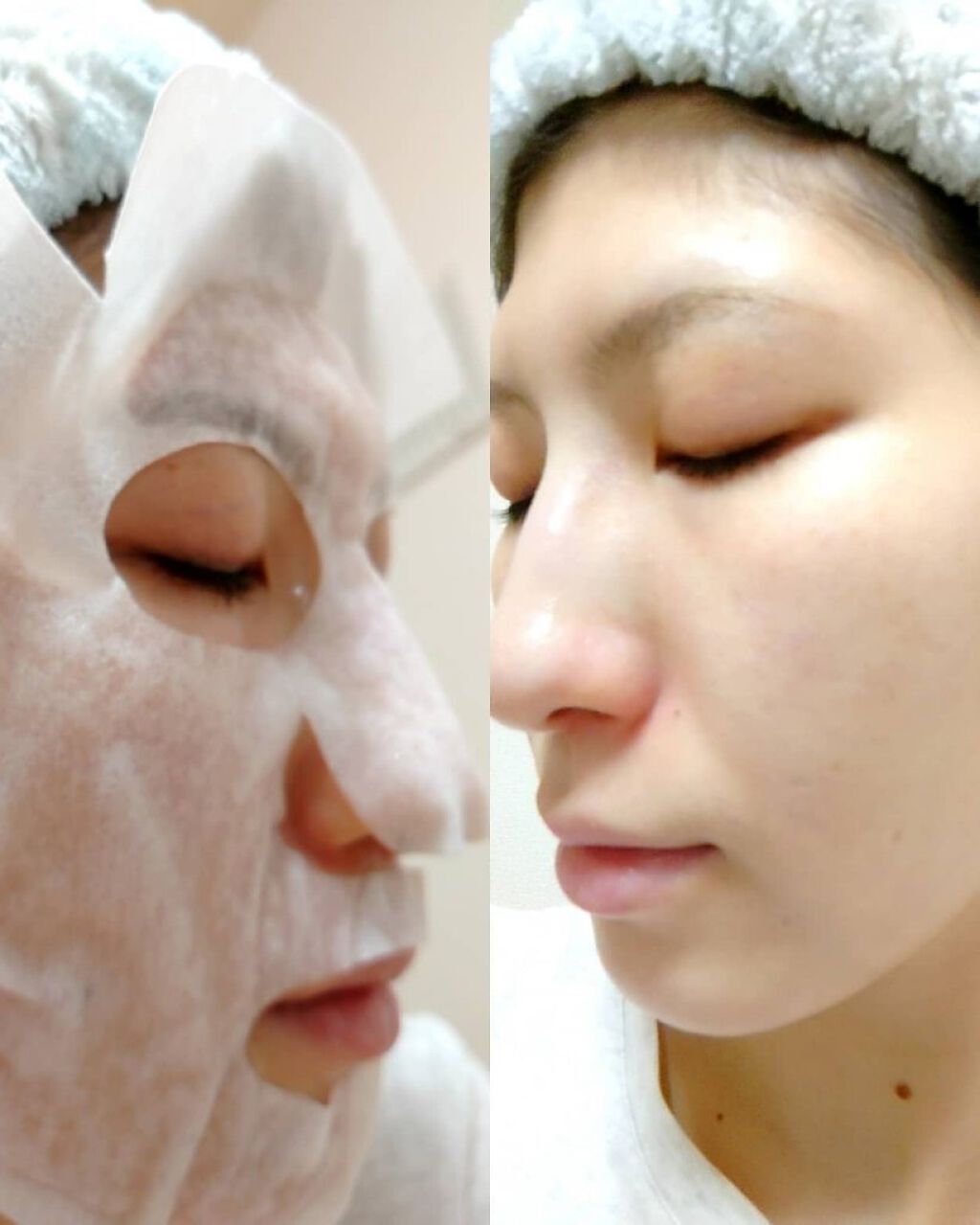 SPARKLING PACK/SERENDI BEAUTY/オールインワン化粧品を使ったクチコミ（3枚目）