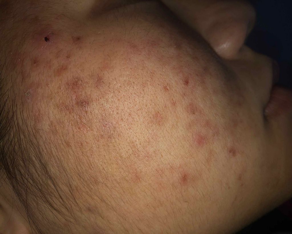 ハトムギ化粧水(ナチュリエ スキンコンディショナー R )/ナチュリエ/化粧水を使ったクチコミ(3枚目)