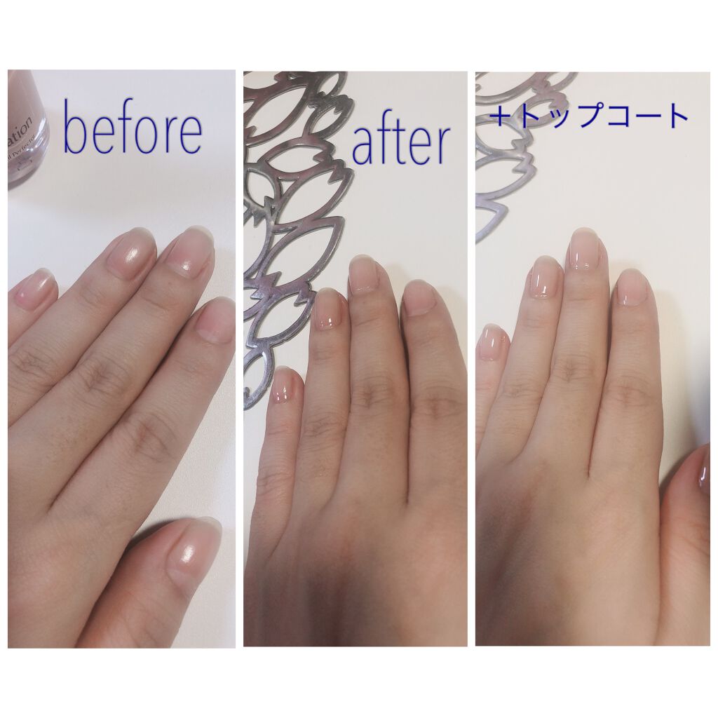 ディーアップファンデーション/D-UP/ネイルベースコートを使ったクチコミ（3枚目）