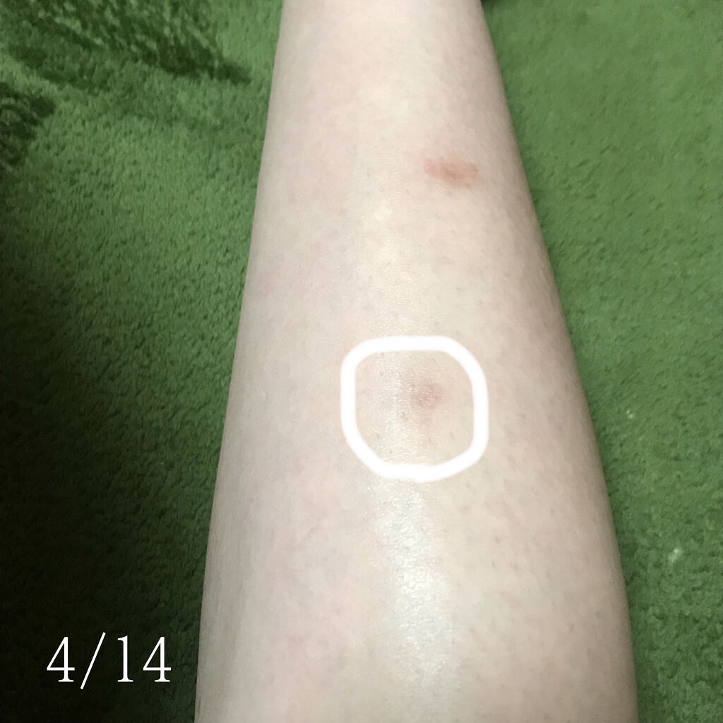 100LAAインパウダー/The Ordinary/その他スキンケアを使ったクチコミ（3枚目）