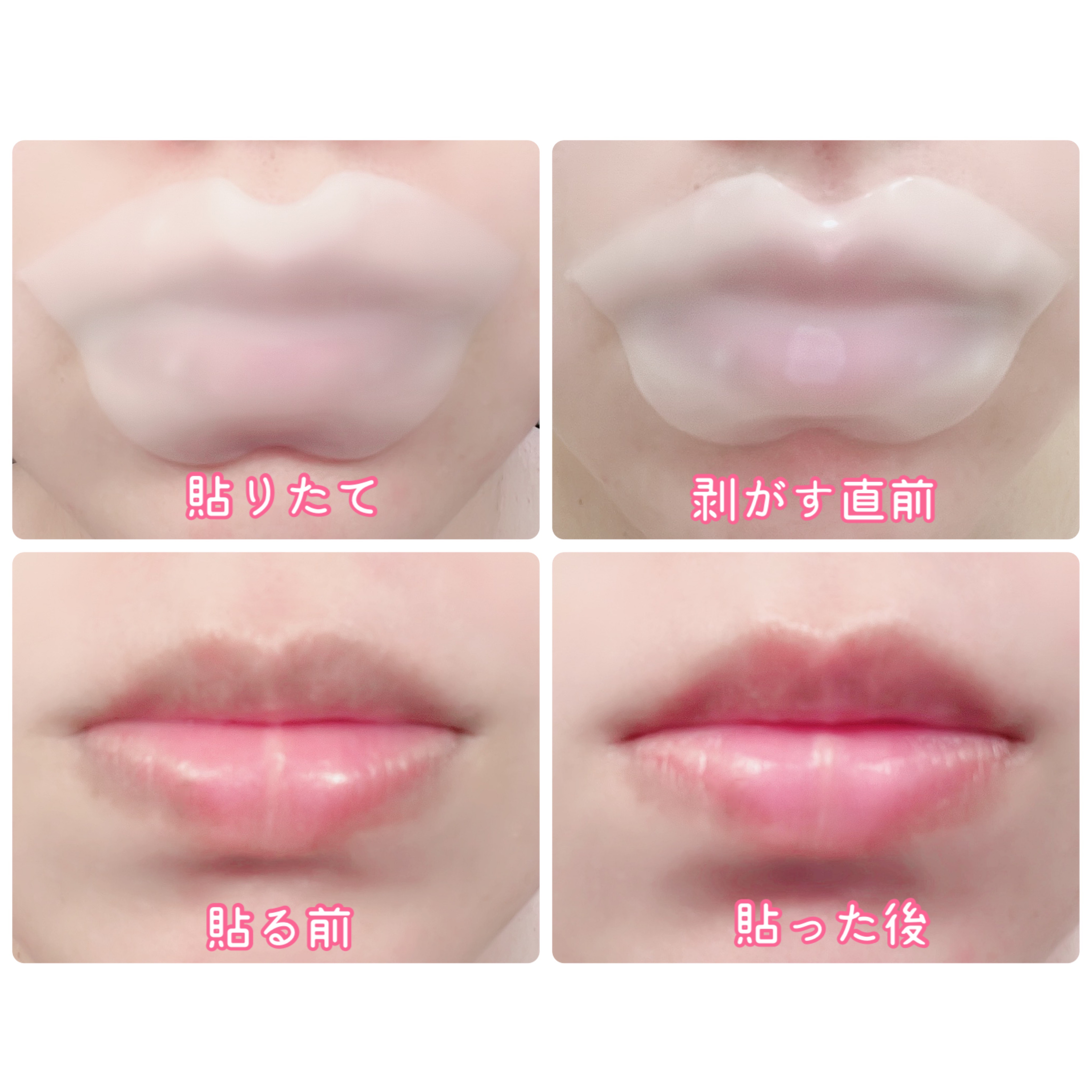 リップパック ふっくらハリ感タイプ＜ハーバルハニーの香り＞/CHOOSY/リップマスクを使ったクチコミ（3枚目）