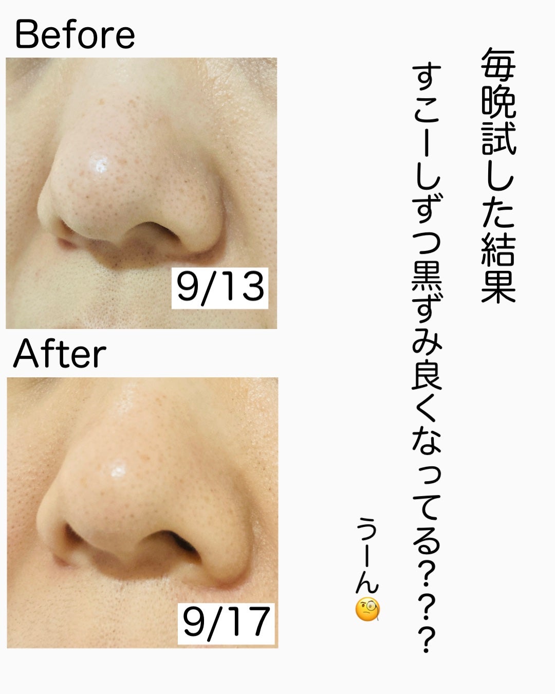 ブラックマグマ ホットクレンジングジェル/ロゼット/クレンジングジェルを使ったクチコミ(7枚目)