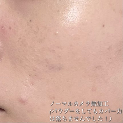 ピンクティーツリーカバープライマークッション/APLIN/クッションファンデーションを使ったクチコミ(9枚目)