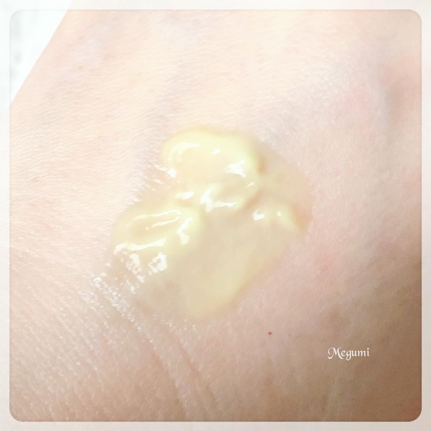 バランシングGAローション/TOUT VERT/化粧水を使ったクチコミ(6枚目)