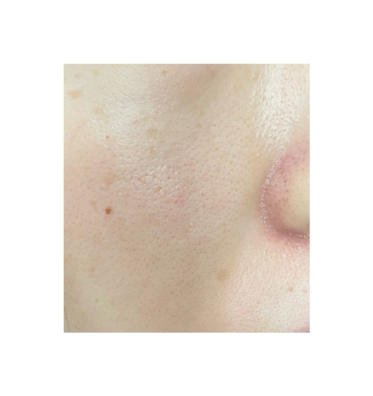 V エッセンス/unlabel/美容液を使ったクチコミ(3枚目)