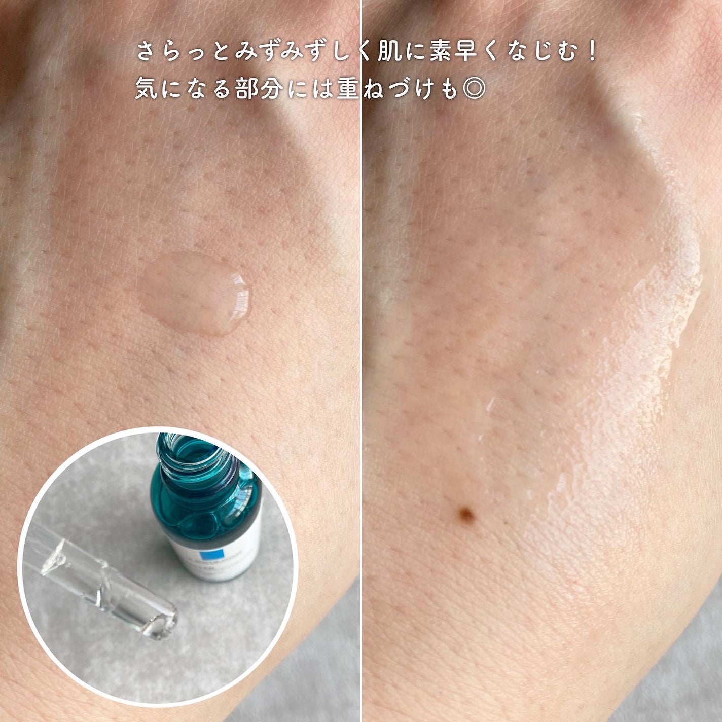 エファクラ ピールケア セラム/ラ ロッシュ ポゼ/美容液を使ったクチコミ(2枚目)