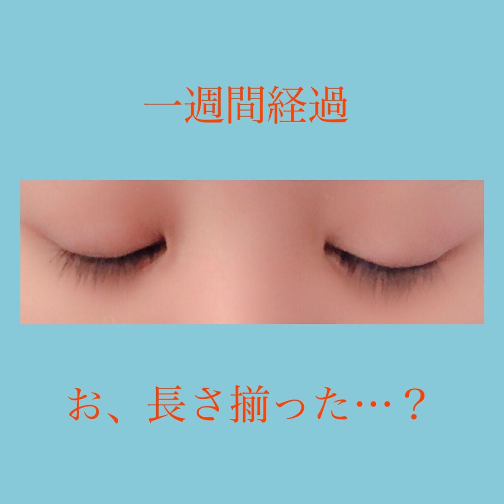 ナチュラルアイビュー/MYM/美容液を使ったクチコミ(2枚目)