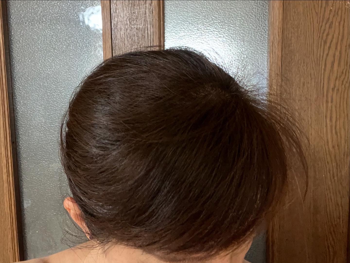 SonoRepro/アンファー(スカルプD)/ヘアケアグッズを使ったクチコミ（2枚目）