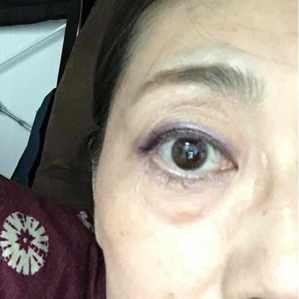 シャイニー ミックスアイズ/RMK/単色アイシャドウを使ったクチコミ（1枚目）