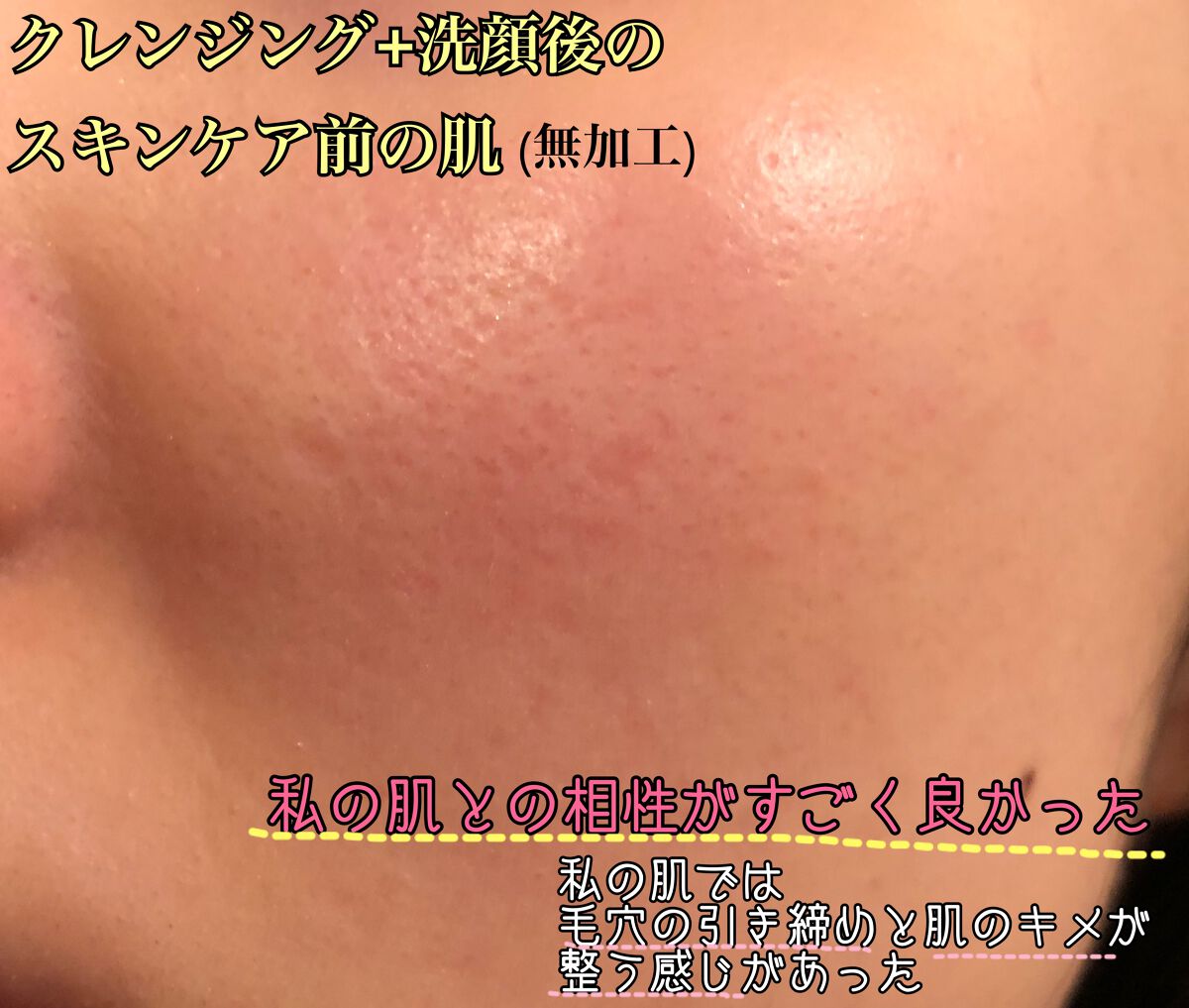 VOCE 2022年10月号/VoCE (ヴォーチェ)/雑誌を使ったクチコミ(9枚目)