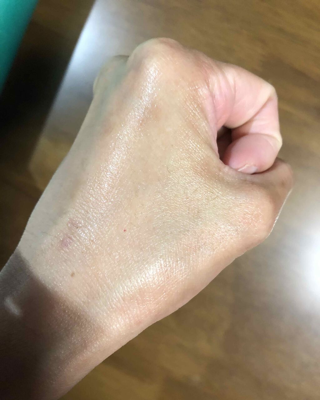 レチノール配合美容液 レチノール20/Celife/美容液を使ったクチコミ(3枚目)