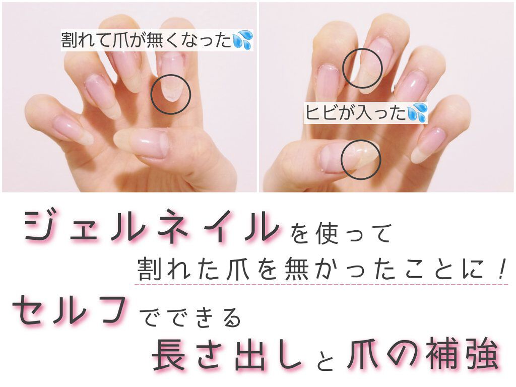 Shジェルネイル ライト対応 セリアを使った口コミ 爪が割れた時の治し方 ネイルの映える爪 By あお 乾燥肌 代後半 Lips
