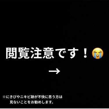 キールズ DS クリアリーブライト エッセンス[医薬部外品]/Kiehl's/美容液を使ったクチコミ（1枚目）