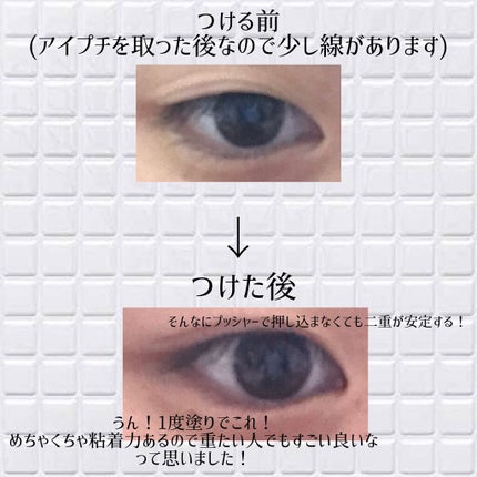 アイビューティー フィクサー WP/アストレア ヴィルゴ/二重まぶた用アイテムを使ったクチコミ(4枚目)