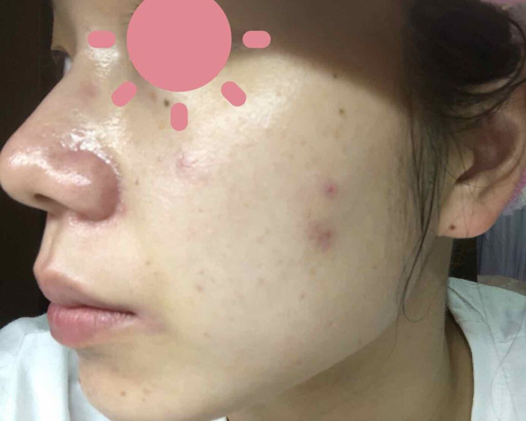 オバジC10セラム/オバジ/美容液を使ったクチコミ(2枚目)