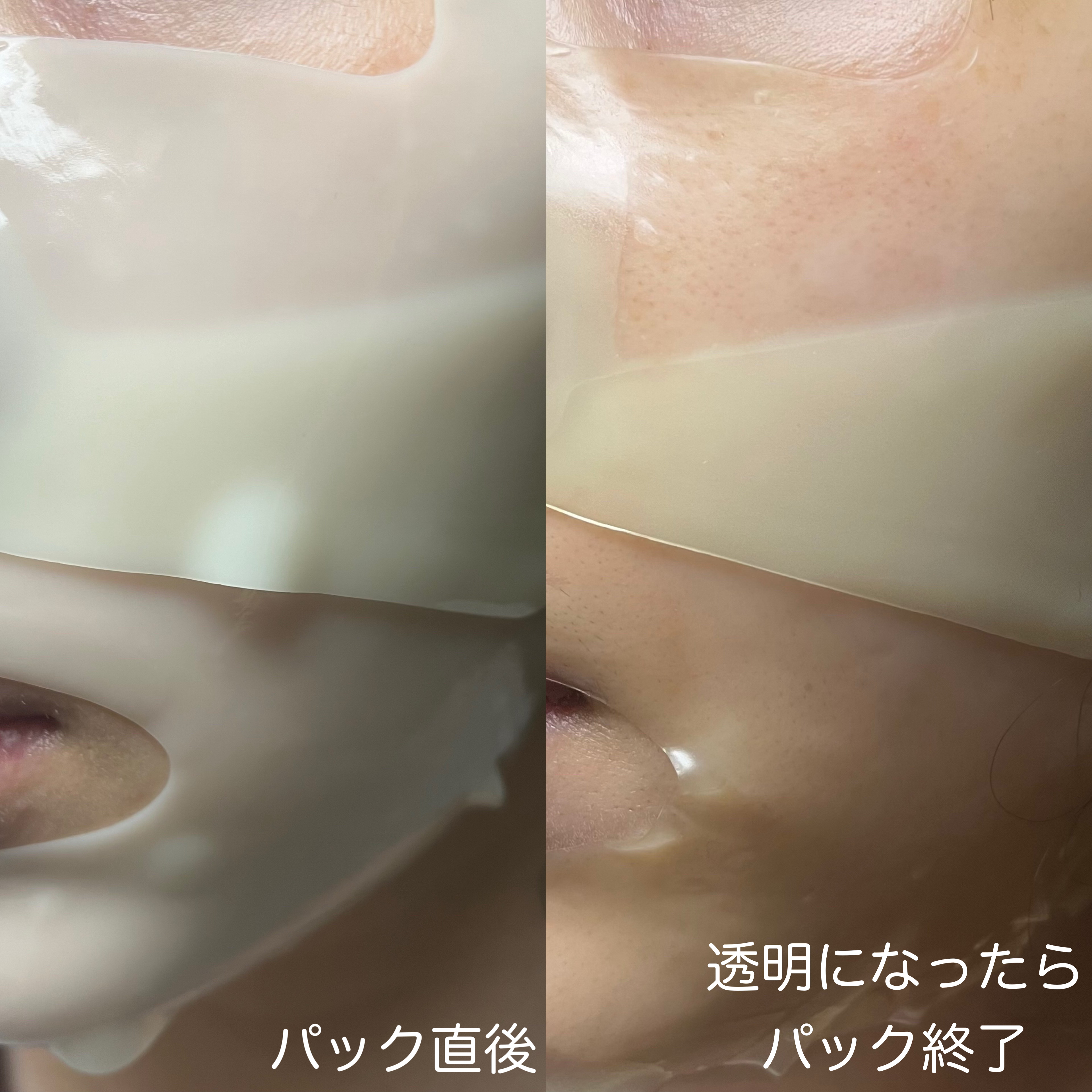 メディアンサー ビタコラーゲンマスク/ABOUT ME/シートマスク・パックを使ったクチコミ（2枚目）